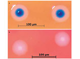      Mycoplasma mycoides,    - 