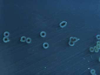  Salmonella typhimurium.  PD/CDC