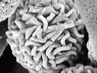   Stachybotrys chartarum,     .   Electron Microscopy Center at North Dakota State University