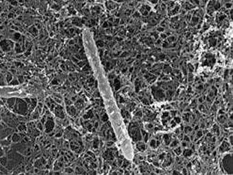  Desulforudis audaxviator.      .   