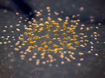  Myxococcus xanthus.  Trance Gemini   wikipedia.org.