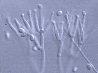   Gliocladium roseum.    botany.utoronto.ca