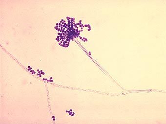 Aspergillus fumigatus  .   Patho   wikipedia.org