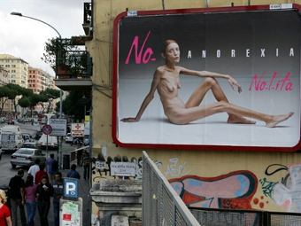       No Anorexia.  ©AFP