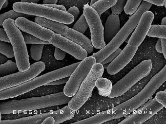     Escherichia coli.  Rocky Mountain Laboratories, NIAID, NIH